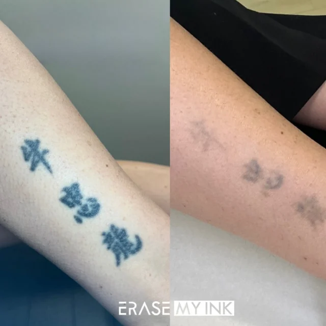 how much can a tattoo fade after one session?